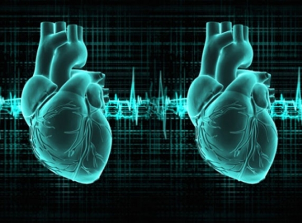 71 year old US man with two hearts who lived after double heart attack