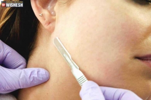 Dermaplaning is a trending technique for a Smooth Skin