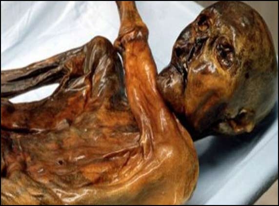 5300-yr-old mummy’s RBC oldest in history
