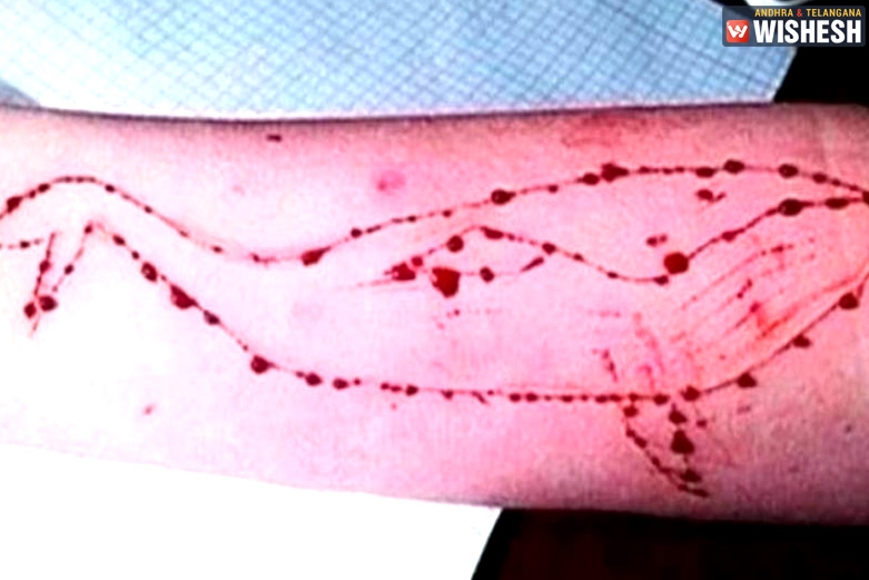 14-Year Old Teenager Leaves Home For “Blue Whale Challenge”, Rescued