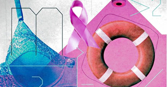 News for breast cancer developments around survivals saga