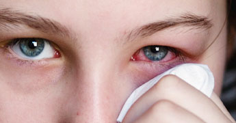 Avoid Eye Infection this Monsoon Season