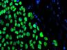 Yokohoma City University, organ transplantation, japan scientists develop human liver in lab, Organ transplant