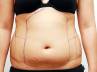 belly exercises, liposuction dangerous, say no to shortcut methods, Methods