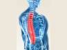 treatment, backbone, osteoporosis it s painful, Backbone