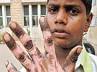 hand immersed in oil, hand immersed in oil, teenage boy s hand immersed in boiling oil, Guruswamy
