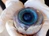 Florida beach, St. Petersburg, giant eye ball recovered off florida beach, Biologist