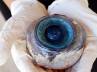 St. Petersburg, St. Petersburg, giant eye ball recovered off florida beach, Biologist