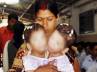 Stuti and Aradhna, twins separated in Madhya Pradesh, conjoined twins separated in mp, Conjoined twins