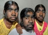 Werewolf syndrome, Sangli sisters, is there be anyone out there to help these miserable souls, Avita