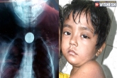 Kolkata child swallows coin, child swallows coin, child refused by four hospitals after coin stucks in his throat, Throat