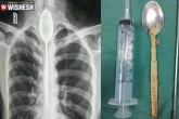 Mr Zhang, Mr Zhang spoon, chinese man swallows spoon stuck in for a year, Chinese man