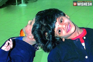 Conjoined Twins Veena-Vani&rsquo;s Parents Approach Govt