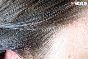 Home Remedies to Prevent White Hair