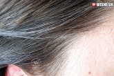 Tips, Health, home remedies to prevent white hair, Home remedies