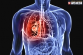 Lung Cancer, tips, home remedies to treat lung cancer, Lung cancer