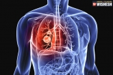 tips, Lung Cancer, home remedies to treat lung cancer, Remedies