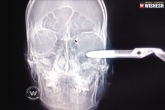 x ray, scissors, pair of scissors sticking out of the head, Scissors