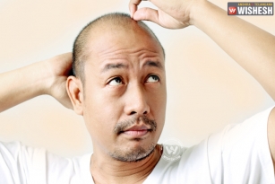 Pluck your hair to treat baldness