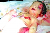 Rats killed boy in Guntur, Rats bitten baby dies, shame on government rats bitten baby dies, Rats