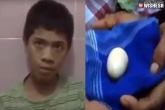 Akmal Indonesia, teenager laying eggs, 14 year teenager lays eggs in front of doctors, Eggs