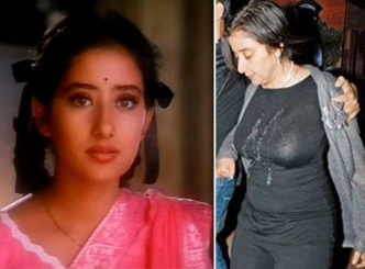 Bollywood actress Manisha Koirala is nearly Unrecognizable