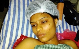 Woman&#039;s hand chopped off completely