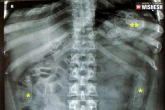 pregnant woman stomach drugs, pregnant woman stomach drugs, woman claims pregnancy hiding drugs in stomach, Pregnant woman
