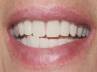 Good Condition, Brush your dentures at least once a day, keep your dentures in good condition clean, Paste