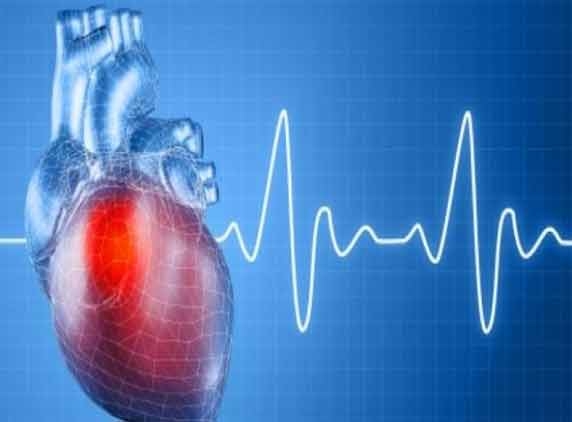 9 weird things linked to heart attacks