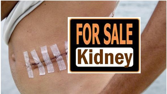 Guntur Kidney Mafia - Human Rights Commission asks Police to investigare