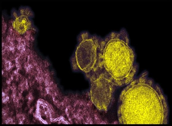 Mysterious virus seems more critical than Sars