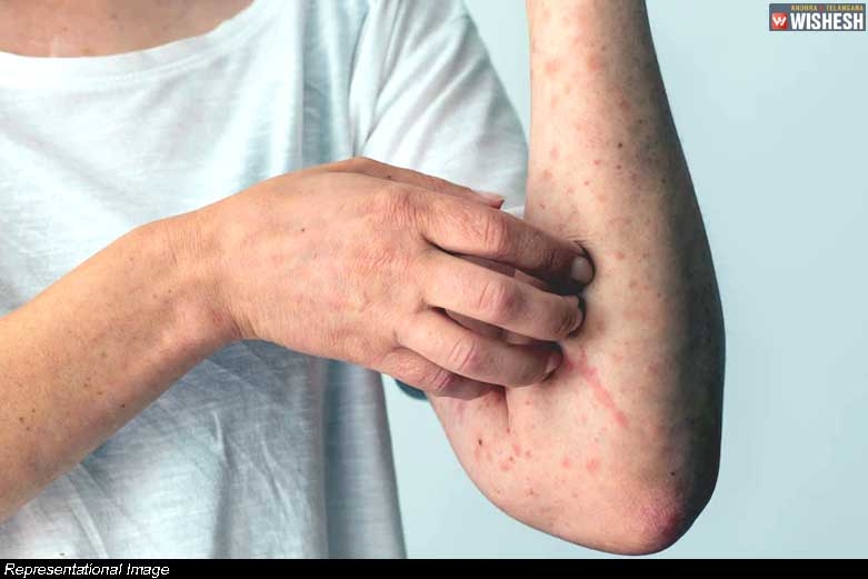 Sexually Transmitted Infections And Their Hidden Symptoms