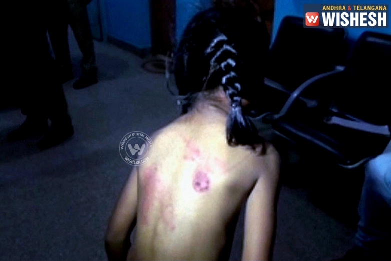 Bengaluru: 7 Year Old Beaten with Belt by her Tuition Teacher