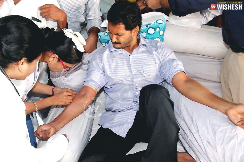 Not Naidu, it is Jagan’s strategy to obstruct fast